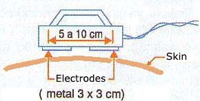 Figure 1 - In this portable assembly, the electrodes consist on metal plates.
Figure 1 - In this portable assembly, the electrodes consist on metal plates.