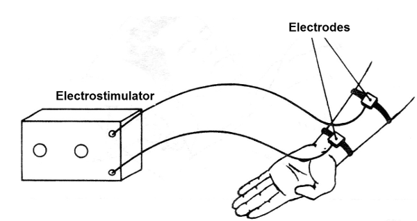 Figure 7 - An electrostimulator
Figure 7 - An electrostimulator