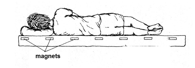 Figure 1 - An application of magnet therapy
Figure 1 - An application of magnet therapy